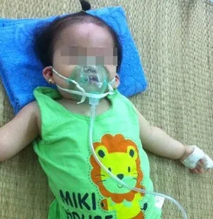 Một trường hợp bệnh nhân viêm phổi phải thở oxy tại khoa Hô hấp