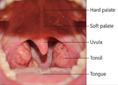 Trong 10 ngày sau cắt amidan: Nên dùng thức ăn mềm, lỏng, nguội, lạnh