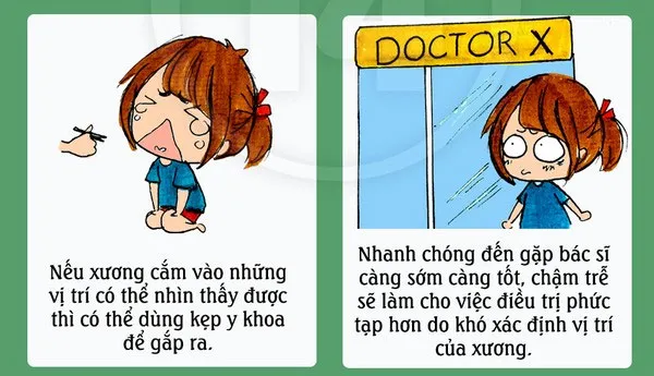Khi bị hóc, cần nhanh chóng đến bác sĩ để gắp xương ra