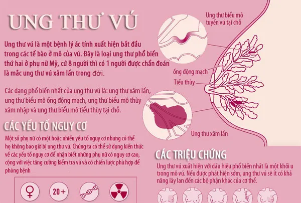 Ung thư vú là bệnh lý ác tính