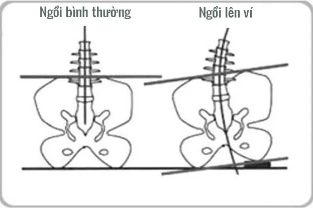 Để ví tiền vào túi sau rất bất tiện khi di chuyển
