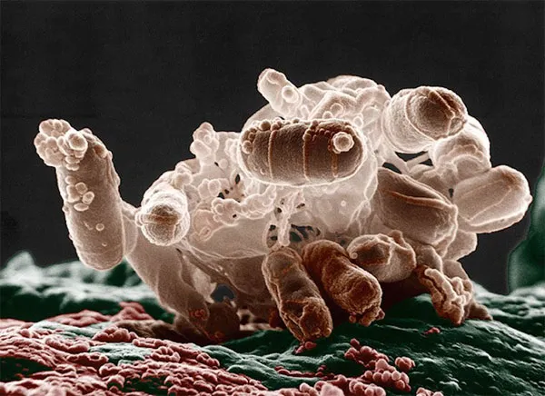 Hình ảnh phóng đại của vi khuẩn E. coli