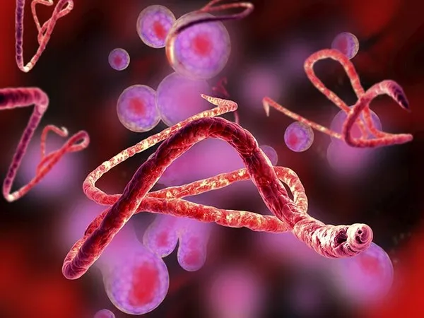Ebola