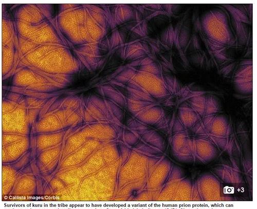 Protein prion
