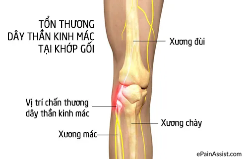 Dây thần kinh