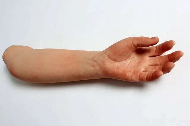 Thậm chí những đôi tay giả có thể đeo nhẫn dễ dàng.