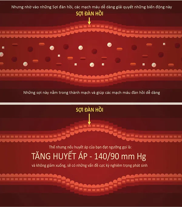 Sợi đàn hồi