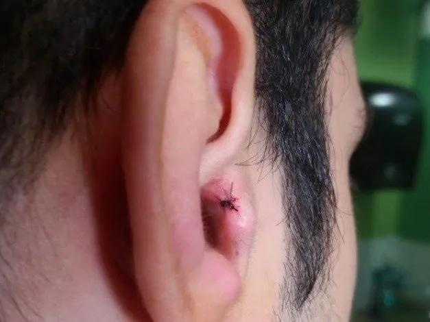 Tai nghe bí mật