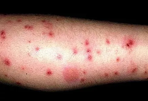 Nước nhuộm vải tiềm ẩn những nguy hiểm gì?