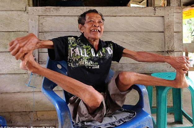 "Người cao su" có khả năng uống dẻo như rắn