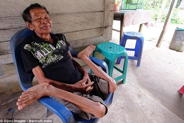 "Người cao su" có khả năng uống dẻo như rắn