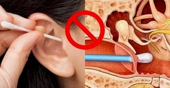 Sau khi xem bức hình này, đảm bảo bạn sẽ không dám ngoáy tai nữa