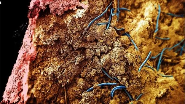 Monhystrella parvella – loài giun tròn được mệnh danh là loài sinh vật sống sâu nhất trong lòng Trái Đất.