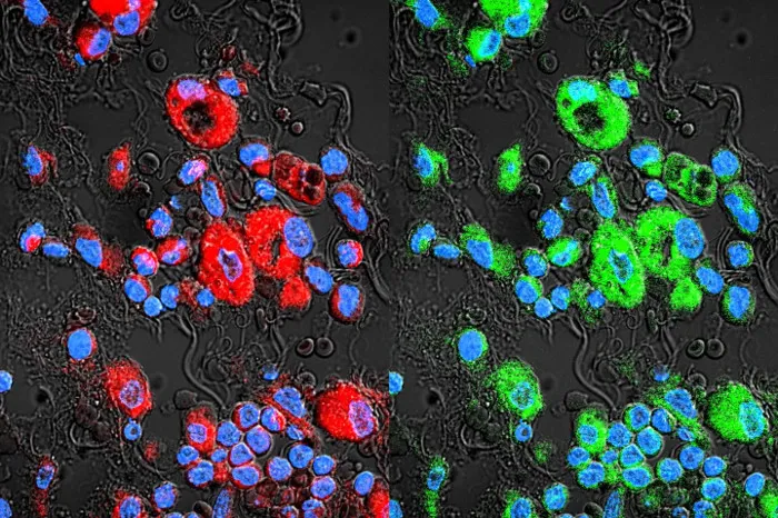 Các tế bào ung thư phổi kháng thuốc (màu đỏ) và exosome (màu xanh lá) chen chúc quanh đó.
