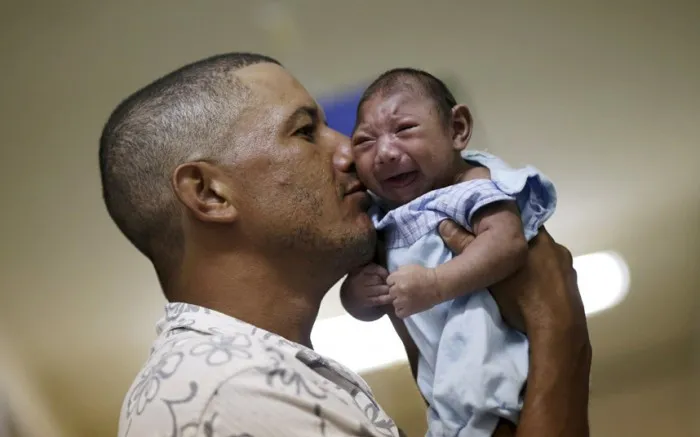 Một người đàn ông ôm đứa con bị bệnh đầu nhỏ tại Bệnh viện Oswaldo Cruz , Recife (Brazil).