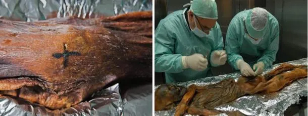 Một hình xăm chữ thập trên đầu gối của Ötzi (trái). Các nhà nghiên cứu lấy mẫu từ hông của người đá năm 2014 (phải).