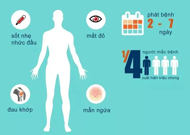 Triệu chứng của người nhiễm virus Zika.