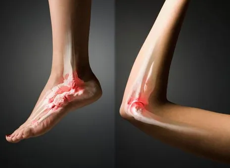 Hợp chất AZA thiết lập nới lỏng các kết nối của tế bào.