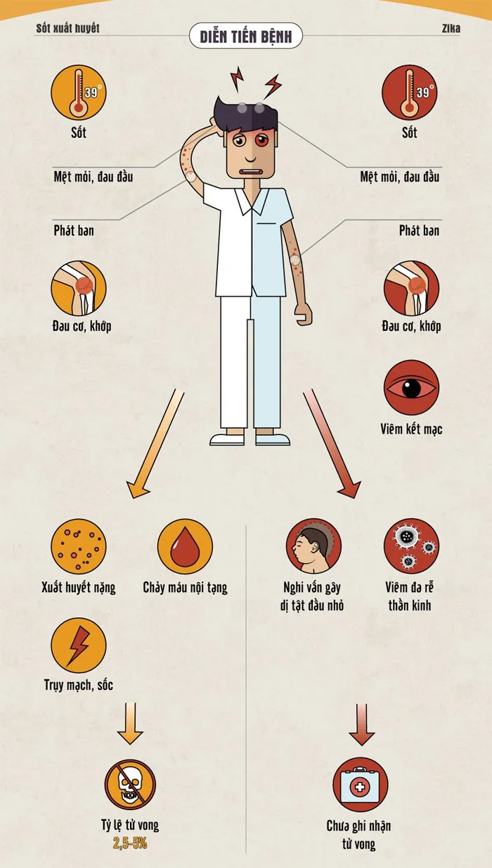 Sốt xuất huyết và Zika đều có một số đặc điểm chung giông nhau như: sốt, phát ban, mệt mỏi, đau đầu, đau khớp....