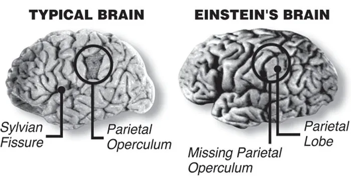 Não của Albert Einstein có một thùy lớn hơn 15% so với bộ não trung bình.
