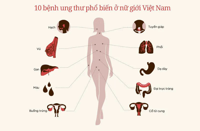 Đối với phụ nữ Việt, ung thư cổ tử cung, buồng trứng, đại trực tràng... là những loại ung thư thường gặp nhất.