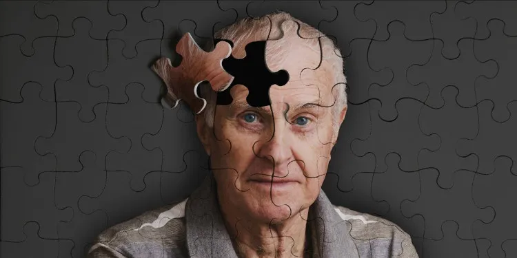Bệnh nhân HIV ngày nay đã sống đủ lâu để mắc Alzheimer.
