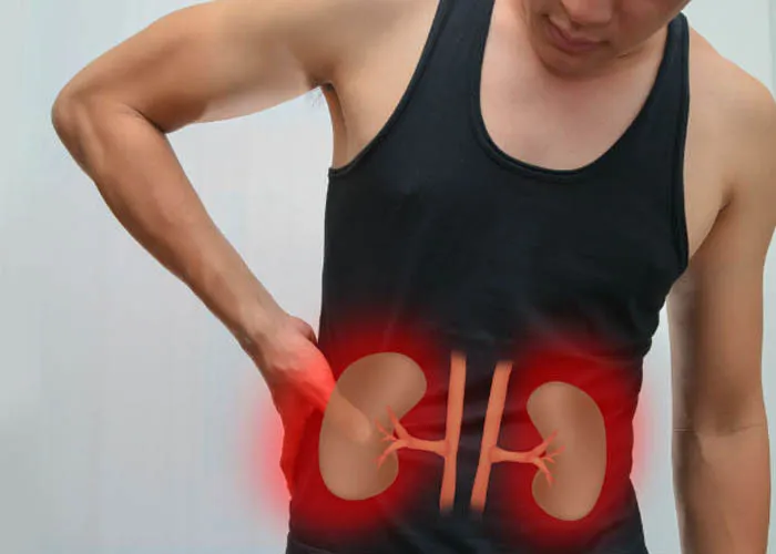 Quá trình hình thành sỏi không có triệu chứng rõ rệt.