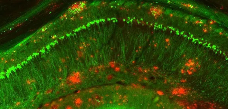 Protein mới có thể đảo ngược các triệu chứng Alzheimer ở chuột. Điều này mở ra triển vọng mới cho việc điều trị Alzheimer ở người.