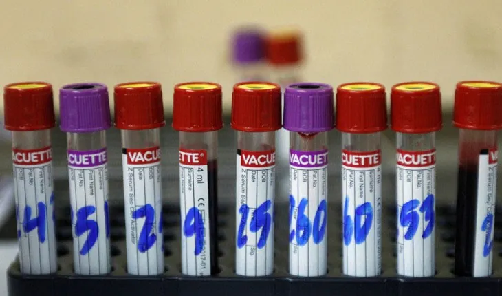 FDA đã thông qua một phương pháp phát hiện sớm Zika.