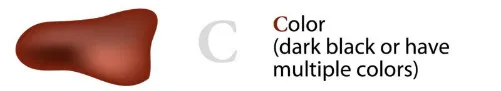 Nốt ruồi có nhiều màu sắc.