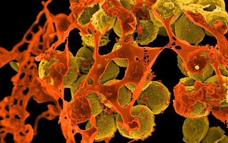 Ảnh hiển vi cho thấy các khuẩn MRSA đang bị bao quanh bởi các mảnh tế bào.