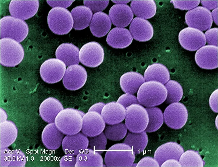 Ảnh chụp mô tả khuẩn Staphyloccocus Aureus.