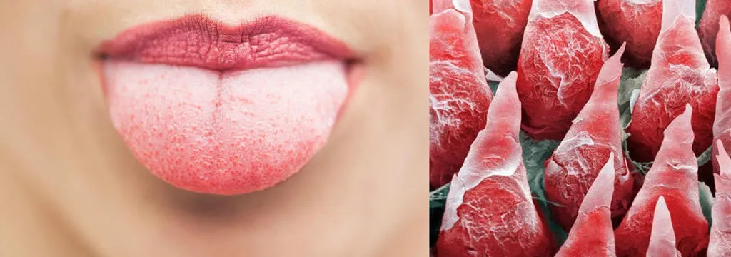 Đây chính là hình ảnh lưỡi của chúng ta khi được phóng to.