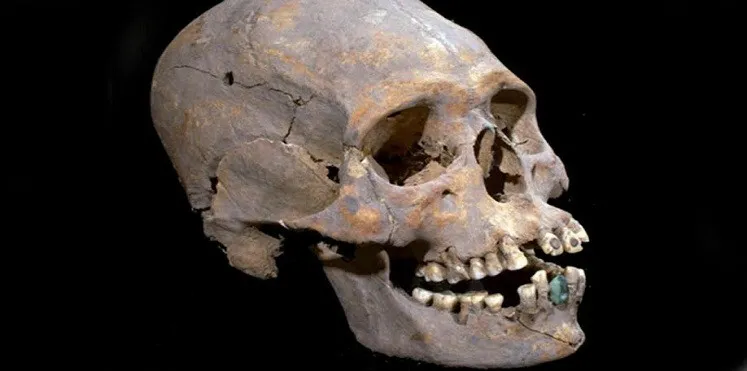 Hộp sọ phụ nữ kéo dài với hàm răng nạm đá quý được phát hiện tại Teotihuacan, Mexico.