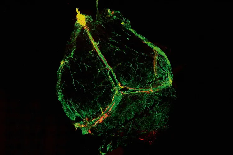 Hình ảnh phát sáng của mạch bạch huyết.