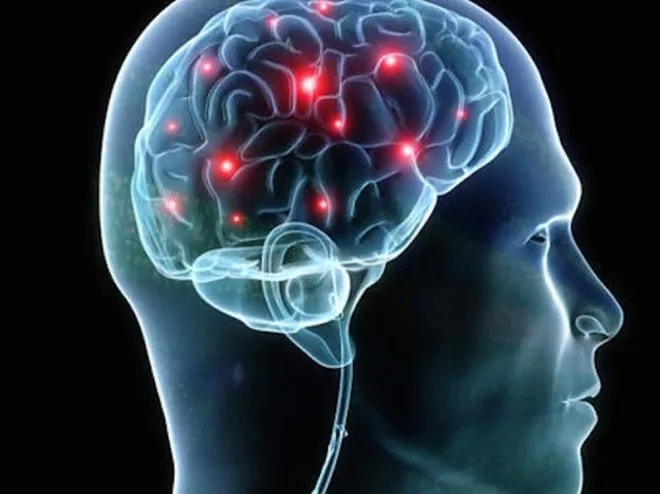 Rối loạn hành vi giấc ngủ REM thường gắn liền với những căn bệnh thần kinh như Parkinson.
