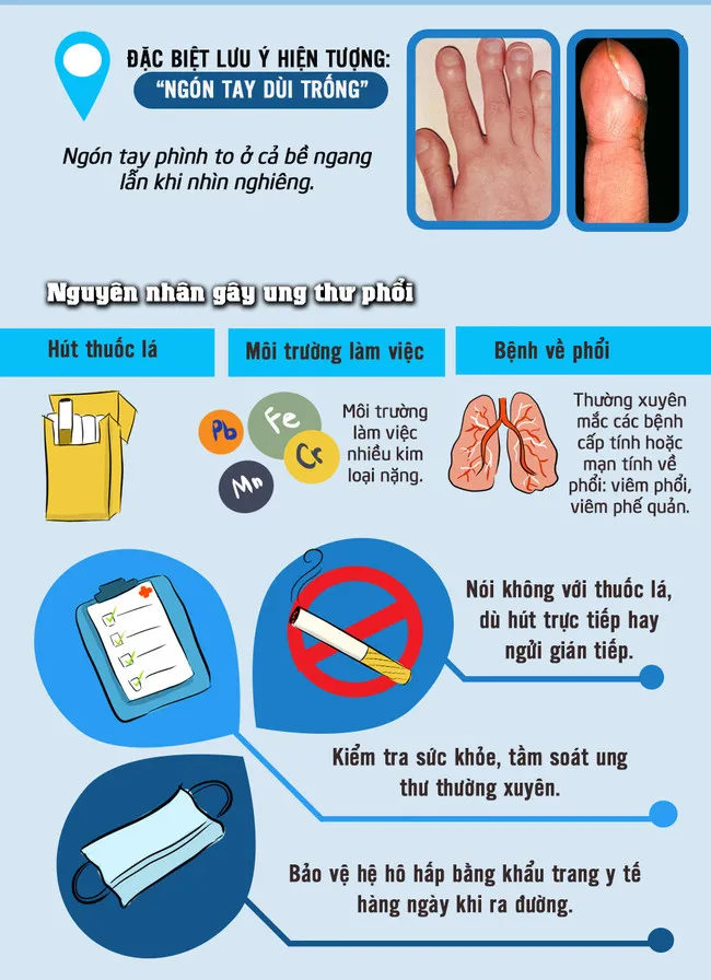 Nguyên nhân gây ra ung thư phổi gồm có: hút thuốc lá, môi trường làm việc nhiều kim loại nặng hoặc mắc bệnh về phổi.