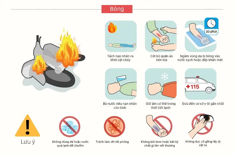 Khi bị bỏng, cần tách nạn nhân ra khỏi vật cháy, cởi bỏ đi quần áo bén lửa.