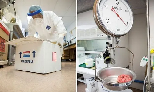 Chỉ những bộ não còn tươi mới được sử dụng trong nghiên cứu y khoa