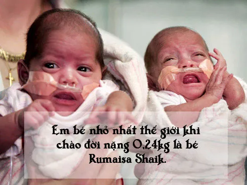 Em bé nhỏ cân nhất thế giới sống sót