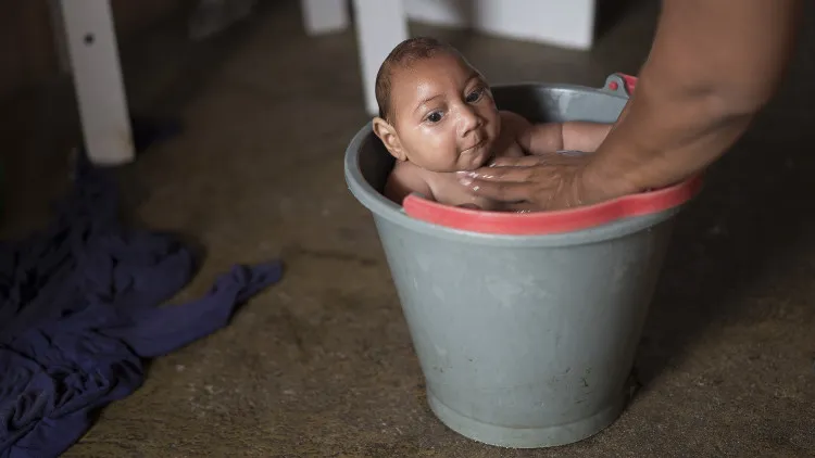 Biến chứng nguy hiểm của virus Zika là gây teo não và rối loạn hệ thống miễn dịch tác động đến thần kinh.