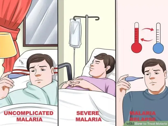 Sốt rét thường có 3 loại phổ biến: sốt rét không biến chứng, sốt rét nghiêm trọng và sốt rét tái phát.