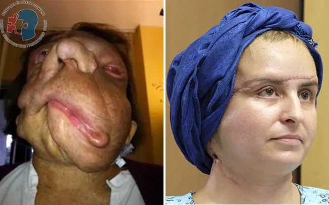 Sự thay đổi đáng kinh ngạc của Joanna.