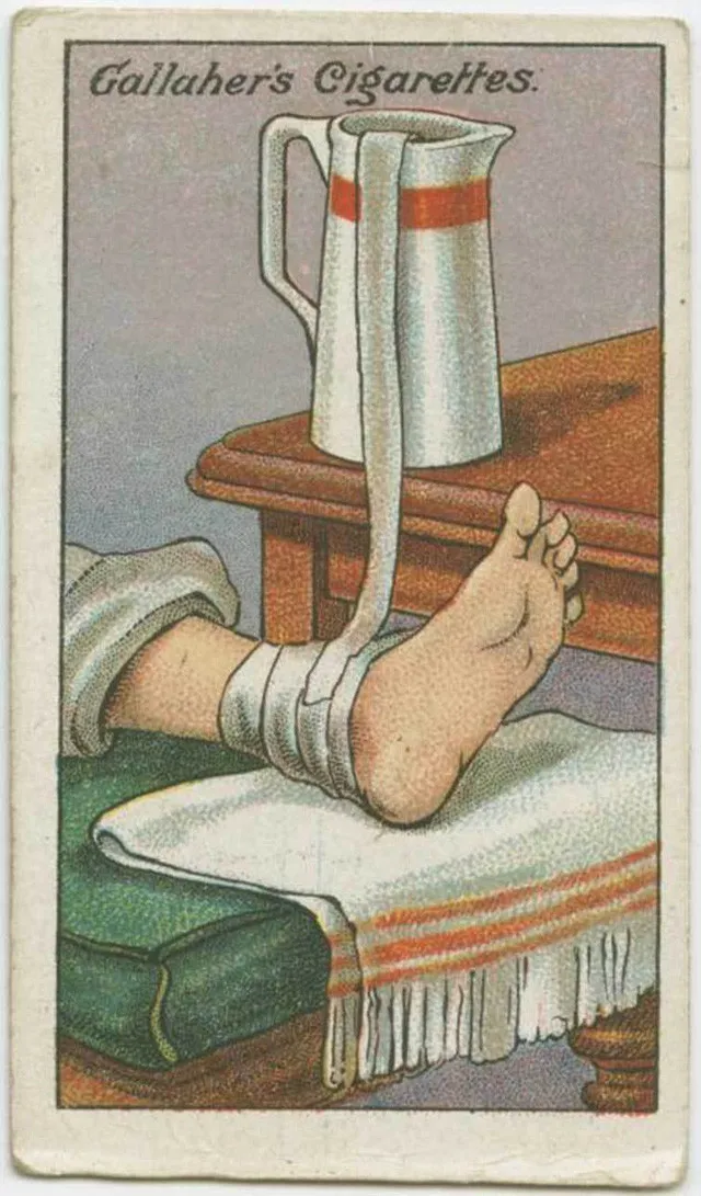 Đối phó với bong gân