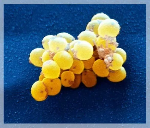 Vi khuẩn Staphlococcus epiderrmis
