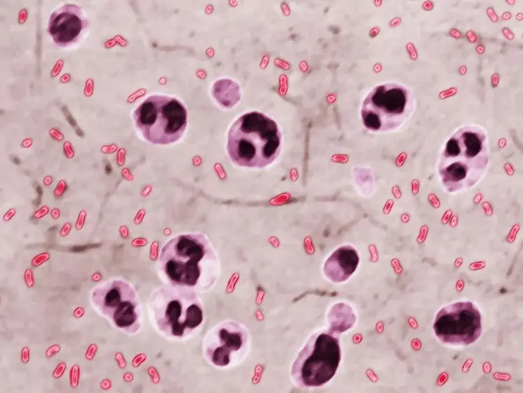 Vi khuẩn Yersinia pestis gây ra "cái chết đen".