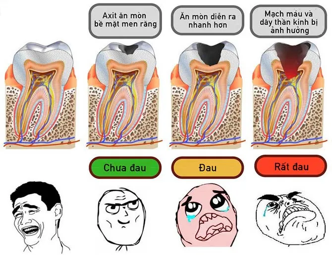 Về cơ bản, sâu răng là sự suy giảm dần dần sức khỏe răng miệng.