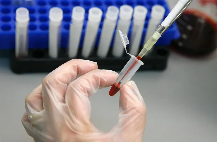 Đường máu là con đường lây truyền HIV nhanh nhất.