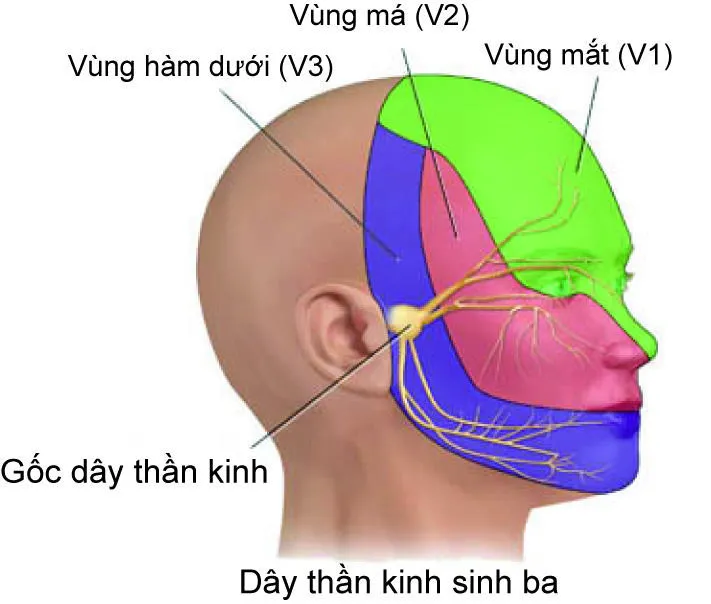 Chúng ta có thể nói rằng tất cả những cơn đau đầu đều do sự thay đổi trong hoạt động của hệ thần kinh sinh ba