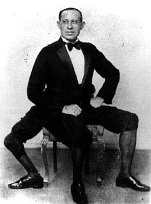 Francesco Lentini - người đàn ông 3 chân